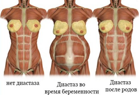 Послеродовой период: на что обращаем внимание | Блоги | Медицинский центр Святой Параскевы в Киеве